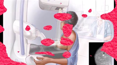 mammography biweekely compression test|what is a mammogram question.